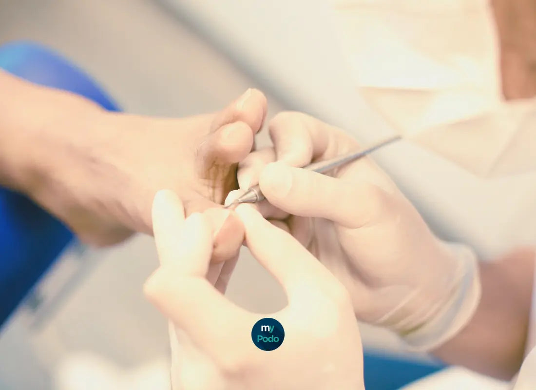 L'Histoire de la profession de Pédicure-Podologue : Un voyage à travers les Âges - My Podologie