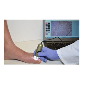 Microscope Médical - Podoscope 1,3 MP - Dino-Lite Dino-Lite 