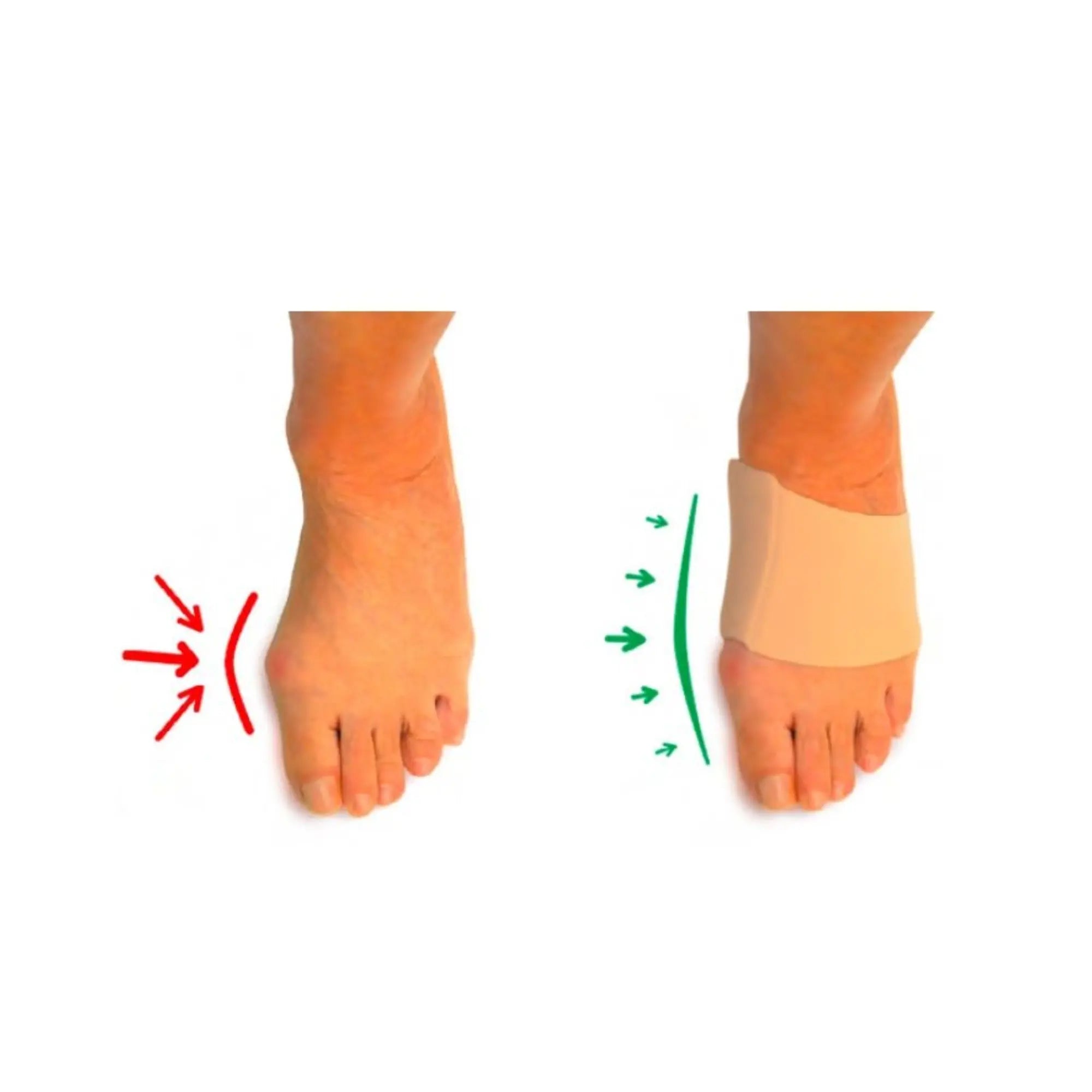 Protection Hallux Valgus - Taille S - Herbitas Fresco Podologia 